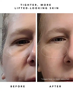 Suero Facial BLIW Marca Blanca 30 ml 1% Bakuchiol + Péptidos Alternativa al Retinol Hidratante Natural con Extracto de Fruta de Monn - Product Image 5