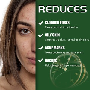 Crème <span class=keywords><strong>pour</strong></span> le visage South Moon Collagen Vitamine <span class=keywords><strong>hydratante</strong></span> anti-âge, anti-acné et anti-taches, éclaircissante et correctrice - Product Image 4