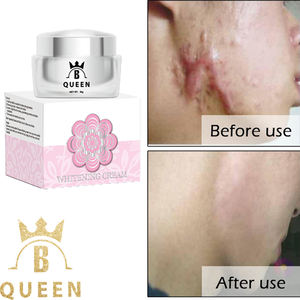 Crema blanqueadora para la <span class=keywords><strong>piel</strong></span>, 100% Natural, a base de hierbas, efecto rápido, para reducir la pigmentación - Product Image 4