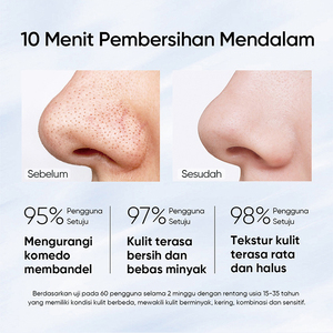 Soins de la peau naturels <span class=keywords><strong>acide</strong></span> <span class=keywords><strong>glycolique</strong></span> Spa pores propres en profondeur réduire les points noirs exfolier et détoxifier le <span class=keywords><strong>masque</strong></span> de boue d'argile volcanique d'Alaska pour l'acné - Product Image 4