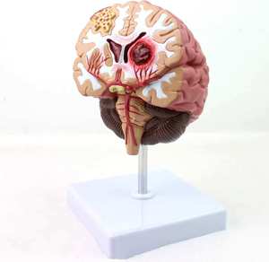 GelsonLab HSBM-564 Modelo de Cerebro Tipo Maniquí para Epilepsia, Hemorragia Cerebral y Patología de Malformación Arteriovenosa - Product Image 1