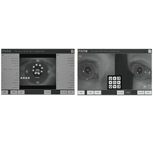 Biometro Óptico Automático OB-S02, Dispositivo <span class=keywords><strong>de</strong></span> Medición <span class=keywords><strong>de</strong></span> Longitud Axial Ocular con Alineación Automática e Impresora Térmica para Oftalmología - Product Image 5