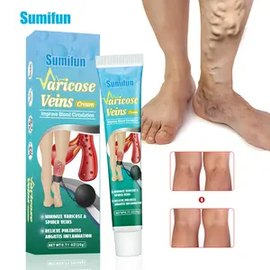 Crema para venas varicosas Alivio de venas Dolor Flebitis Angiitis Crema de hierbas