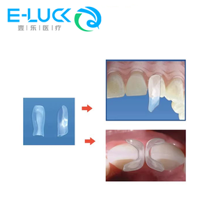 Hoja de moldeo <span class=keywords><strong>transparente</strong></span> dental para cirugía dental <span class=keywords><strong>dientes</strong></span> anteriores hoja de formación de triángulo negro banda de matriz dental - Product Image 3