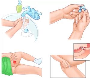 Supositorio Vaginal de Ácido Hialurónico de Marca Privada, Cuidado Íntimo Diario, Supositorio Femenino para Reafirmar la Vagina, con pH Equilibrado - Product Image 5