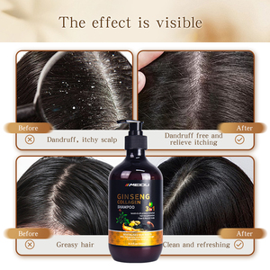 Shampoo Herbal au Collagène et au Ginseng 500ml – Nettoyage en Profondeur, Contre les Pellicules et les Démangeaisons du Cuir Chevelu – Soin Capillaire – Meilleures Ventes - Product Image 6