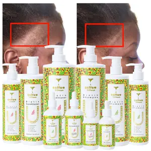 Il tuo marchio shampoo organico oem olio di cocco biotina shampoo e balsamo per la cura dei capelli set per la crescita dei capelli