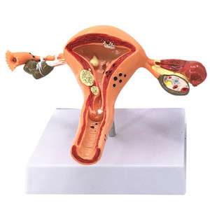 Sistema reproductor femenino humano: modelo anatómico y patológico del útero, la vagina y los ovarios; material didáctico para - Product Image 2