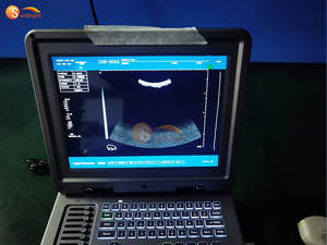 Utilisation vétérinaire SUN-806A Équipement d'imagerie diagnostique médicale Scanner à ultrasons 2D <span class=keywords><strong>portable</strong></span> - Product Image 3