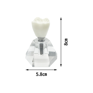 Modèle de <span class=keywords><strong>dent</strong></span> unique pour implant dentaire, modèle de prothèse dentaire en cristal, modèle de <span class=keywords><strong>couronne</strong></span>, structure de typodont pour la formation, la pratique, l'enseignement et l'affichage - Product Image 6