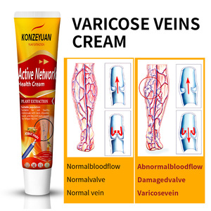 Crema Corporal para el Alivio de <span class=keywords><strong>las</strong></span> Venas Varicosas, Herbal, Calmante, Hipoalergénica, para Venas Hinchadas, Sensibles y Dilatadas, Favorece la Comodidad de <span class=keywords><strong>las</strong></span> <span class=keywords><strong>Piernas</strong></span>, OEM - Product Image 3