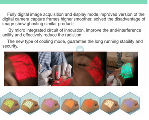 Yüz ameliyatı için VF12 pediatrik kan damarı bulucu/ven dedektörü/taşınabilir damar bulucu - Product Image 6