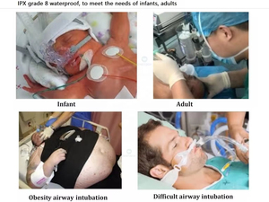 CR-MIL00 CR-MIL0 CR-MAC1 CR-MAC2 Hastane Tıbbi Dijital Laringoskop Uygun Fiyatlı Yeniden Kullanılabilir Video Laringoskop - Product Image 4