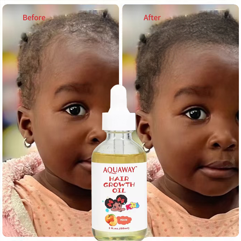 Private Label 100ml Anti Hair Fall