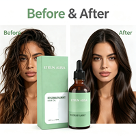 ETRUN Label pribadi minyak rambut nutrisi Rosemary Mint ketombe kontrol menghaluskan kulit kepala kering mengurangi rambut jatuh ujung terbelah