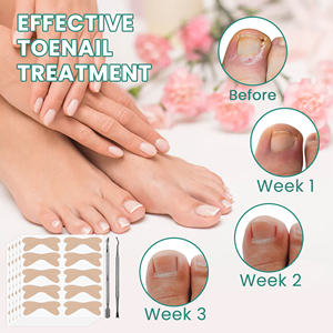 สติกเกอร์แก้ไขเล็บที่ดีต่อสุขภาพใช้ได้กับเล็บเท้า - Product Image 5