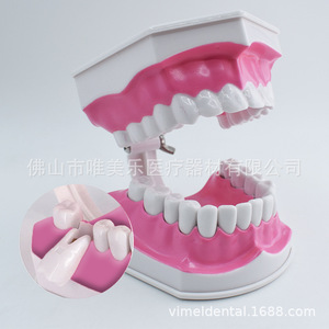 Orthodontic Dental Model Semi-Ceramic Semi-Metal <b>Brackets</b> <b>Plastic</b> Implant Prosthesis for Doctor-Patient Communication Teaching - Product Image 4