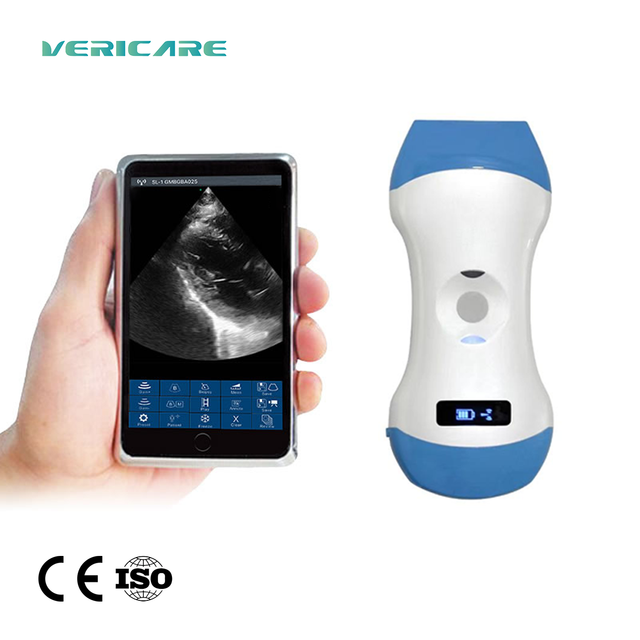 Wireless Ultrasound Scanner JM-5CPL Portable Color Doppler Ultrasonic Machine AI Mode Best Seller for Veterinary Human Use