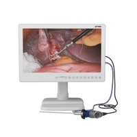 Sistema de Cámara Endoscópica Portátil Todo en Uno IKEDA 1080P Full HD con Monitor de 22 Pulgadas y Fuente de Luz LED para Laparoscopia y Cirugía ORL