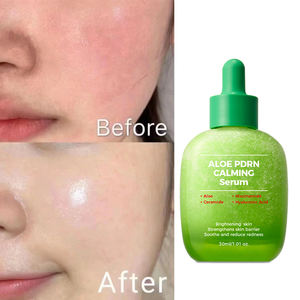 Sérum Visage Hydratant Réparateur Apaisant à l'Acide Hyaluronique Biologique OEM, Sérum à l'Aloe Vera et au PDRN - Product Image 1