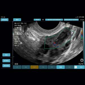 Sondes transvaginales convexes à double tête bon marché, échographes portables sans fil - Product Image 6