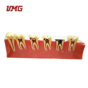 Gesectioneerd Met Pulpziekte Aandoeningen Parodontale Ziekten Classificatiemodel - Product Image 3