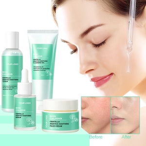 Cuidado DE LA PIEL coreano Centella Asiatica CICA <span class=keywords><strong>Kit</strong></span> Anti-envejecimiento Reafirmante Brillo Cuidado DE LA PIEL Set para mujeres Piel grasa - Product Image 2