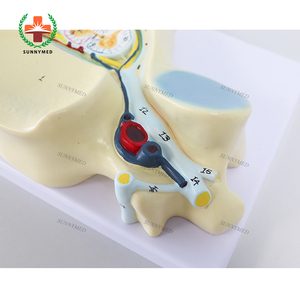 ซันนี SY-N028โมเดลการตัดไขสันหลังที่มีคุณภาพสูงเพื่อการศึกษาการบาดเจ็บที่สมบูรณ์/กล้ามเนื้อเกร็งที่เกิดจากการกระตุ้นให้เกิด - Product Image 5