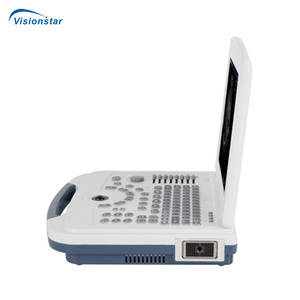 Ubw580 đầy đủ kỹ thuật số hình ảnh 2D 12.1inch HD LCD trung gian hiển thị máy tính xách tay Loại B/W Máy siêu âm - Product Image 4