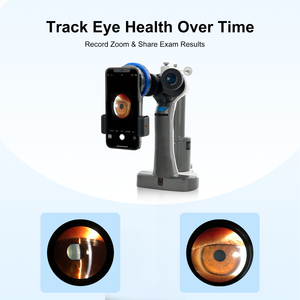 Lámpara de Hendidura Portátil Oftálmica Aist Optics FSL-P en Oferta - Product Image 4