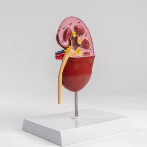Modelo de Riñón Patológico, Modelo Anatómico Humano para Enseñanza Médica, Demostración de Nefritis, <span class=keywords><strong>Urología</strong></span> Renal, Hospital - Product Image 5