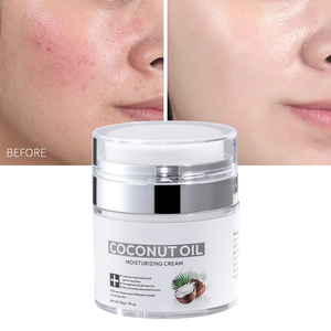 Ventes chaudes Crème hydratante pour le visage 50g Soin de la peau Hydratation profonde Éclaircissement Réparation Huile de noix de coco - Product Image 1
