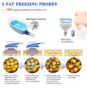 Professionale 360 cryo cool dimagrante <span class=keywords><strong>crioterapia</strong></span> antigelo membrana fisioterapia <span class=keywords><strong>macchina</strong></span> con cavitazione - Product Image 6