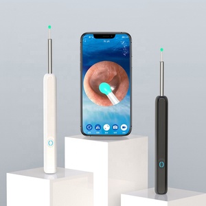 Limpiador de Oídos Inteligente Inalámbrico Visual Otoscopio de Alta Definición con Cámara Herramienta Luminosa para Extracción de Cera - Product Image 1