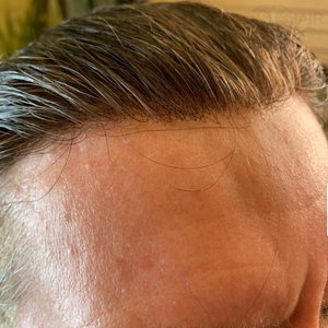 Kbeth Peluca de Cabello Humano Natural Hecho a Mano <span class=keywords><strong>para</strong></span> Hombre Calvo, Estilo de Moda <span class=keywords><strong>2021</strong></span> - Product Image 1