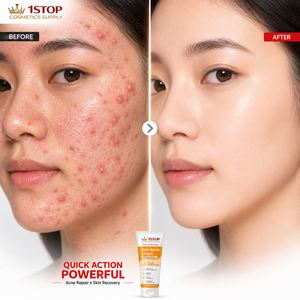 Crema Iluminadora <span class=keywords><strong>Belle</strong></span>] para Uniformar el Tono, Mejorar la Luminosidad, Cuidado de la Barrera de Humectación, Piel Radiante, Textura Suave, Uso Diario, Producto Terminado - Product Image 1
