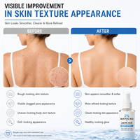Brume Corporelle Séchage Rapide pour le Dos, les Bras et les Jambes, Anti-Acné et Exfoliante (Acide Salicylique 2%, Acide Lactique, Niacinamide)