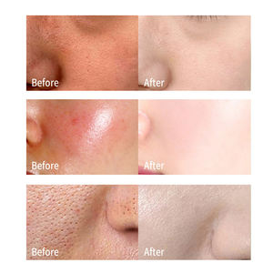 도매 300g 순수 천연 유기농 얼굴 스킨 케어 알로에 베라 꿀 오이 코직산 진정 보습 젤 - Product Image 6