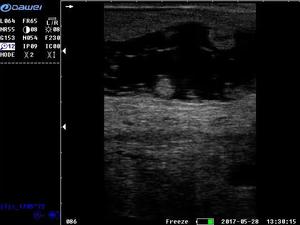Dawei S1 kinh tế nhất chuyên nghiệp bác sĩ thú y máy siêu âm thú y mang thai scan máy cho cừu, bò, ngựa, Chó - Product Image 5