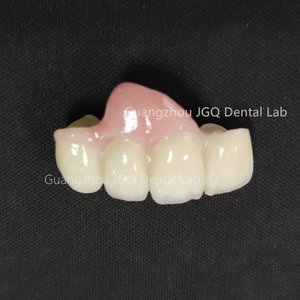 Proveedor de dentaduras personalizadas de alta precisión <span class=keywords><strong>CAD</strong></span>/CAM Dientes DE CIRCONIA sólida completa con precio competitivo para laboratorios dentales en el extranjero - Product Image 5