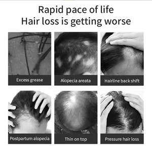 Лидер продаж, органическое масло для волос с листьями розмарина, частная марка, высококачественный экстракт розмарина, уход за кожей головы, масло для роста волос - Product Image 4