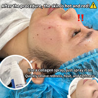 Spray facial au bio-collagène de qualité médicale pour peaux sensibles post-traitement OEM, réparation cutanée, éclaircissement et rajeunissement de la peau au collagène