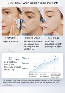 El mejor <span class=keywords><strong>corrector</strong></span> de manchas oscuras, piel natural, blanqueamiento verdadero, crema para eliminar manchas oscuras y pecas - Product Image 3