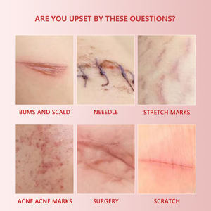 Crema Reparadora para Suavizar y Aclarar Cicatrices, Repara la Piel Traumatizada, Aclara Cicatrices Quirúrgicas, Suaviza la Piel - Product Image 3