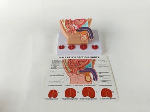 Ciência médica humana pelve masculina Cavidade Doença sagital Anatomia ensino modelos - Product Image 5