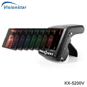 Sistema de Ultrasonido Veterinario Portátil KX-5200 a <span class=keywords><strong>Precio</strong></span> Económico - Product Image 4