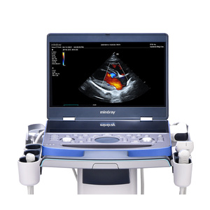 Échographe Doppler couleur standard Mindray Vetus 7 à double écran tactile pour diagnostic vétérinaire, chariot pour chien - Product Image 3