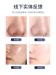 เครื่องดูแลผิวหน้าอเนกประสงค์ 11 in 1 ได้รับการรับรองมาตรฐาน CE ใช้สำหรับดูแลผิว ลดรอยสิว กระชับผิว - Product Image 6