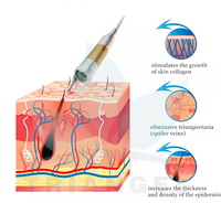 Nouveau laser KTP Nd Yag 980 nm pour l'élimination vasculaire, l'élimination des varices, machine à laser à impulsions longues