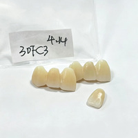 Bloque de Zirconia Multicapa Ivista 4D-ML en Oferta, 45%-59% de Translucidez, 700-1000 MPa, para Proyectos de Rejuvenecimiento Dental